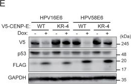 Fig.5.E showing Western Blotting in a Homo sapiens (Human) sample from the publication: High-risk HPV E6 induces an aneuploidy-prone chromosome congression defect through destabilization of CENP-E.