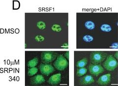 Fig.2.D showing Immunocytochemistry-immunofluorescence from the publication: The splicing factor kinase, SR protein kinase 1 (SRPK1) is essential for late events in the human papillomavirus life cycle.