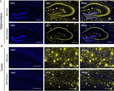 Fig.1.C showing Immunohistochemistry-immunofluorescence from the publication: Synaptic Vesicle Glycoprotein 2A Suppresses Amyloidogenesis Beyond Its Synaptic Role: A Novel Mechanism Disrupting BACE1 Binding and Altering APP Localization.