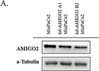 Fig.7.A showing Western Blotting from the publication: AMIGO2 as a Novel Biomarker Predicting Poor Prognosis and Associated with Adhesion-Driven Metastasis in Pancreatic Adenocarcinoma.