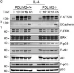 Fig.5.C showing Western Blotting from the publication: PDLIM2 is highly expressed in Breast Cancer tumour-associated macrophages and is required for M2 macrophage polarization.