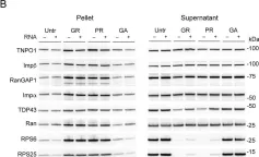 Fig.5.B showing Western Blotting from the publication: C9orf72 arginine-rich dipeptide repeat proteins disrupt karyopherin-mediated nuclear import.
