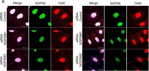 Fig.6.C showing Immunocytochemistry-immunofluorescence in a Homo sapiens (Human) sample from the publication: The association of UBAP2L and G3BP1 mediated by small nucleolar RNA is essential for stress granule formation.