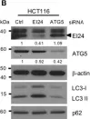 Fig.3.B showing Western Blotting in a Homo sapiens (Human) sample from the publication: EI24, as a Component of Autophagy, Is Involved in Pancreatic Cell Proliferation.