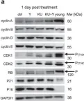 Fig.5.A showing Western Blotting from the publication: Co-inhibition of ATM and ROCK synergistically improves cell proliferation in replicative senescence by activating FOXM1 and E2F1.