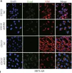 Fig.3.E showing Immunocytochemistry-immunofluorescence from the publication: ZEB2 facilitates peritoneal metastasis by regulating the invasiveness and tumorigenesis of cancer stem-like cells in high-grade serous ovarian cancers.