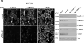 Fig.1.B showing Western Blotting in a Homo sapiens (Human) sample from the publication: p120ctn and P-cadherin but not E-cadherin regulate cell motility and invasion of DU145 prostate cancer cells.