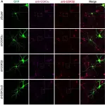Fig.3.A showing Immunocytochemistry-immunofluorescence in a Mus musculus (House mouse) sample from the publication: Structural Plasticity of Dendritic Spines Requires GSK3α and GSK3β.