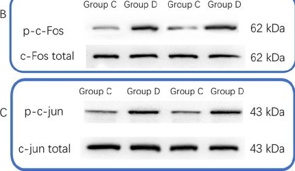 Fig.3.B showing Western Blotting in a Mus musculus (House mouse) sample from the publication: Doxorubicin compromises blood-brain barrier integrity by suppressing annexin A1 expression.