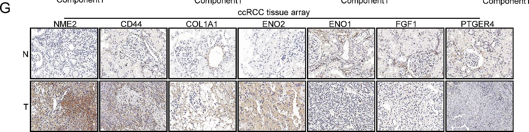 Fig.3.G showing Immunohistochemistry from the publication: Cellular senescence and metabolic reprogramming model based on bulk/single-cell RNA sequencing reveals PTGER4 as a therapeutic target for ccRCC.