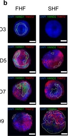 Fig.4.B showing Immunocytochemistry-immunofluorescence from the publication: Self-assembling human heart organoids for the modeling of cardiac development and congenital heart disease.
