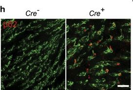 TSC but not PTEN loss in starving cones of retinitis pigmentosa mice leads to an autophagy defect and mTORC1 dissociation from the lysosome.