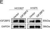 Fig.8.E showing Western Blotting in a Homo sapiens (Human) sample from the publication: RBM15/IGF2BP2-PTPRH m6A regulatory axis in non-small cell lung cancer.