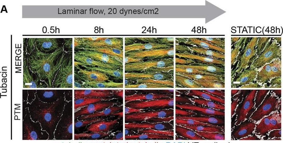 Fig.4.A showing Immunocytochemistry-immunofluorescence from the publication: Endothelial cell elongation and alignment in response to shear stress requires acetylation of microtubules.