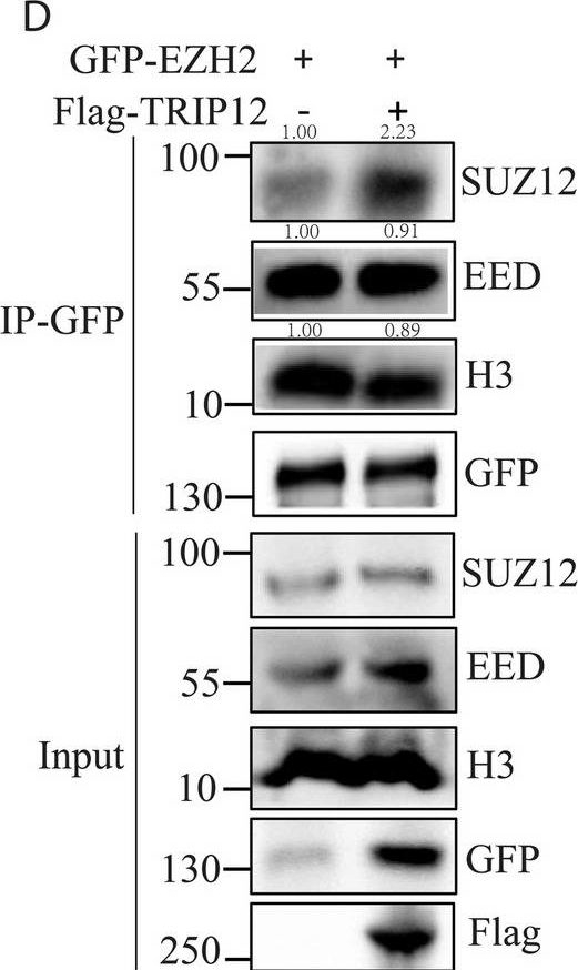 Fig.5.D showing Western Blotting in a Homo sapiens (Human) sample from the publication: EZH2 K63-polyubiquitination affecting migration in extranodal natural killer/T-cell lymphoma.