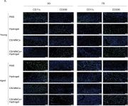 CD11c (D1V9Y) Rabbit Monoclonal Antibody | Cell Signaling Technology