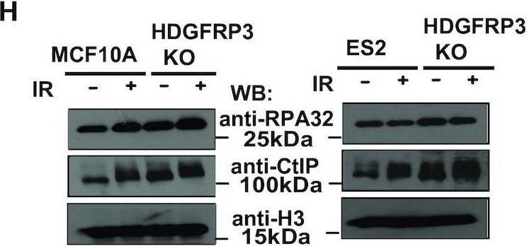 Fig.6.H showing Western Blotting in a Homo sapiens (Human) sample from the publication: HDGFRP3 interaction with 53BP1 promotes DNA double-strand break repair.