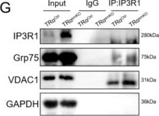 Fig.4.G showing Western Blotting in a Mus musculus (House mouse) sample from the publication: Ageing-Dependent Thyroid Hormone Receptor α Reduction Activates IP3R1-Meditated Ca2+ Transfer in MAM and Exacerbates Skeletal Muscle Atrophy in Mice.