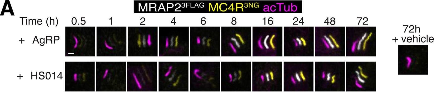 Fig.2.A from the publication: Tonic ubiquitination of the central body weight regulator melanocortin receptor 4 (MC4R) promotes its constitutive exit from cilia.