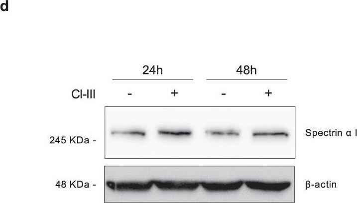 Fig.5.D showing Western Blotting from the publication: Neuronal haemoglobin induces loss of dopaminergic neurons in mouse Substantia nigra, cognitive deficits and cleavage of endogenous α-synuclein.