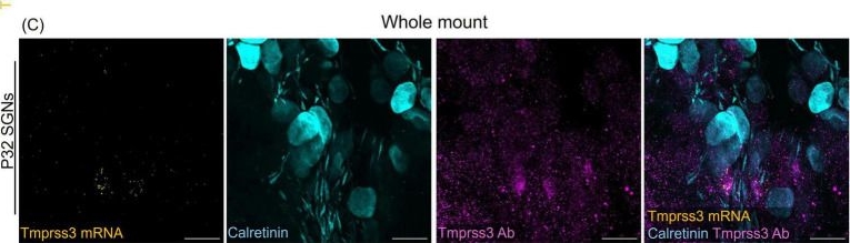Fig.5.C showing Immunohistochemistry-immunofluorescence from the publication: Tmprss3 is expressed in several cell types of the inner ear including type II but hardly in type I spiral ganglion neurons.