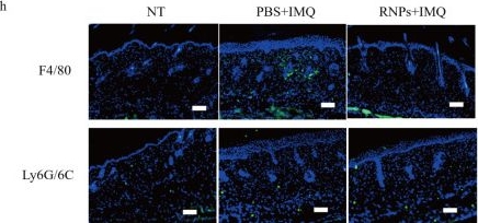 Fig.7.H showing Immunohistochemistry-immunofluorescence in a Mus musculus (House mouse) sample from the publication: Therapeutic Potential of Rose Hip-Derived Nanoparticles for Psoriatic Skin Inflammation.