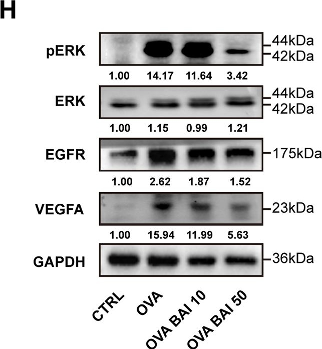 Fig.7.H showing Western Blotting from the publication: VEGF and EGFR signaling pathways are involved in the baicalein attenuation of OVA-induced airway inflammation and airway remodeling in mice.