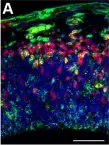 Fig.3.A showing Immunohistochemistry-immunofluorescence in a Mus musculus (House mouse) sample from the publication: A transient role of the ciliary gene Inpp5e in controlling direct versus indirect neurogenesis in cortical development.