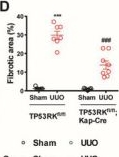 Fig.2.D from the publication: TP53RK Drives the Progression of Chronic Kidney Disease by Phosphorylating Birc5.