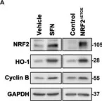 Fig.2.A showing Western Blotting from the publication: Transcription Factor NRF2 Participates in Cell Cycle Progression at the Level of G1/S and Mitotic Checkpoints.