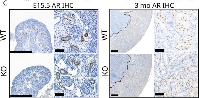 Fig.2.C showing Immunohistochemistry from the publication: Testosterone Exposure During Fetal Masculinization Programming Window Determines the Kidney Size in Adult Mice.