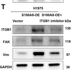 Fig.4.T showing Western Blotting in a Homo sapiens (Human) sample from the publication: USP33 Promotes Lung Adenocarcinoma Brain Metastasis by Inhibiting the K48-Linked Ubiquitination and Degradation of S100A9 and Facilitating Vimentin Secretion.