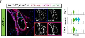 Fig.7.F showing Immunofluorescence in a Mus musculus (House mouse) sample from the publication: Cellular taxonomy of Hic1+ mesenchymal progenitor derivatives in the limb: from embryo to adult.
