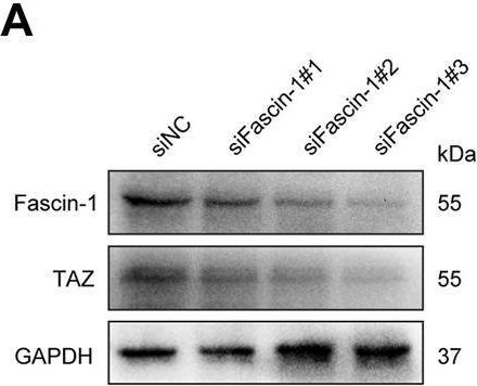 Fig.6.A showing Western Blotting from the publication: TAZ Induces Migration of Microglia and Promotes Neurological Recovery After Spinal Cord Injury.