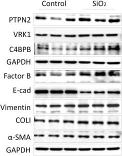Fig.4.A showing Western Blotting in a Mus musculus (House mouse) sample from the publication: Protein Expression Profile in Rat Silicosis Model Reveals Upregulation of PTPN2 and Its Inhibitory Effect on Epithelial-Mesenchymal Transition by Dephosphorylation of STAT3.