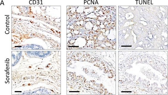 Fig.3.A showing Immunohistochemistry from the publication: Evaluation of in vivo responses of sorafenib therapy in a preclinical mouse model of PTEN-deficient of prostate cancer.