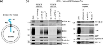 Fig.2.A showing Western Blotting from the publication: Selective immunocapture reveals neoplastic human mast cells secrete distinct microvesicle- and exosome-like populations of KIT-containing extracellular vesicles.