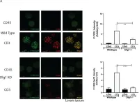 Fig.2.A showing Immunocytochemistry-immunofluorescence from the publication: Disc Large Homolog 1 Is Critical for Early T Cell Receptor Micro Cluster Formation and Activation in Human T Cells.