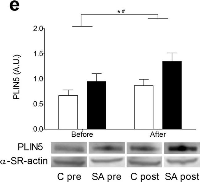 Lipid droplet dynamics and insulin sensitivity upon a 5-day high-fat diet in Caucasians and South Asians.