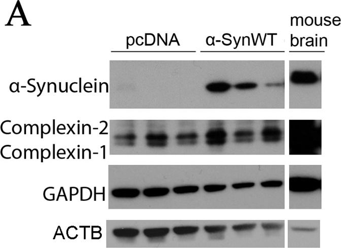 Fig.5.A showing Western Blotting in a Homo sapiens (Human) sample from the publication: Blood RNA biomarkers in prodromal PARK4 and rapid eye movement sleep behavior disorder show role of complexin 1 loss for risk of Parkinson's disease.