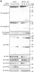 Fig.5.D showing Western Blotting in a Homo sapiens (Human) sample from the publication: Linear ubiquitination is involved in the pathogenesis of optineurin-associated amyotrophic lateral sclerosis.
