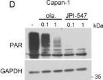 Fig.1.D showing Western Blotting in a Homo sapiens (Human) sample from the publication: JPI-547, a Dual Inhibitor of PARP/Tankyrase, Shows Antitumor Activity Against Pancreatic Cancers with Homologous Recombination Repair Deficiency or Wnt-Addiction.