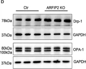 Fig.6.D showing Western Blotting from the publication: ADP-Ribosylation Factor-Interacting Protein 2 Acts as a Novel Regulator of Mitophagy and Autophagy in Podocytes in Diabetic Nephropathy.