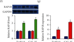 Fig.3.F showing Western Blotting in a Homo sapiens (Human) sample from the publication: lncRNA DLEU2 Accelerates Oral Cancer Progression via miR-30a-5p/RAP1B Axis to Regulate p38 MAPK Signaling Pathway.