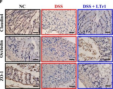 Fig.1.F showing Immunohistochemistry in a Mus musculus (House mouse) sample from the publication: LTr1 alleviates DSS-induced ulcerative colitis by modulating macrophages to inhibit M1 polarization and associated inflammatory responses.