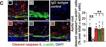 Fig.2.C showing Immunohistochemistry-immunofluorescence in a Mus musculus (House mouse) sample from the publication: Cationic proteins from eosinophils bind bone morphogenetic protein receptors promoting vascular calcification and atherogenesis.