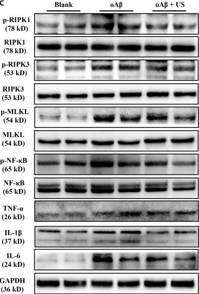 Fig.6.C showing Western Blotting from the publication: Transcranial Ultrasound Stimulation Pulsed at 40 Hz Improves Cognition and Neuroinflammation in Female Mice with Alzheimer's Disease.