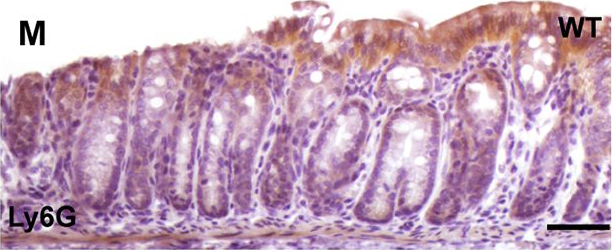 Fig.5.M showing Immunohistochemistry in a Mus musculus (House mouse) sample from the publication: hnRNP I regulates neonatal immune adaptation and prevents colitis and colorectal cancer.