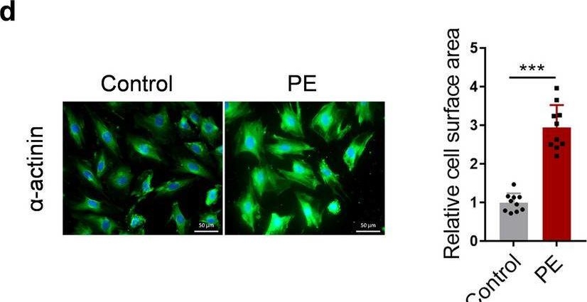 Fig.2.D showing Immunocytochemistry-immunofluorescence from the publication: Poly (ADP-ribose) polymerases 16 triggers pathological cardiac hypertrophy via activating IRE1α-sXBP1-GATA4 pathway.