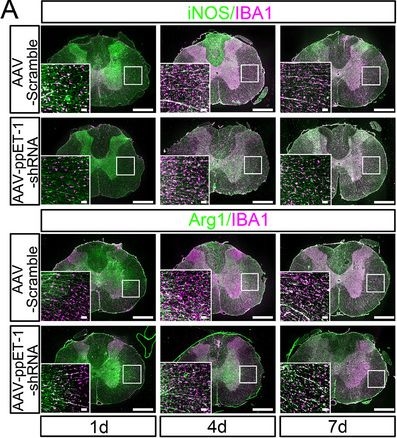 Fig.2.A showing Immunocytochemistry-immunofluorescence from the publication: Astrocytic ET-1 System Determines Microglia Phenotype Following Spinal Cord Injury.